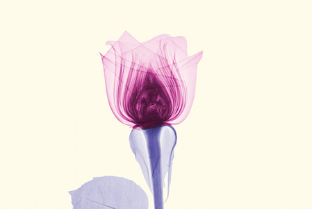 Impresionantes rayos X Florales por el fotógrafo Brendan Fitzpatrick