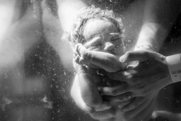 Lee más sobre el artículo Poderosas Fotografías del Parto y Postparto que captan la Belleza y Emoción del nacimiento
