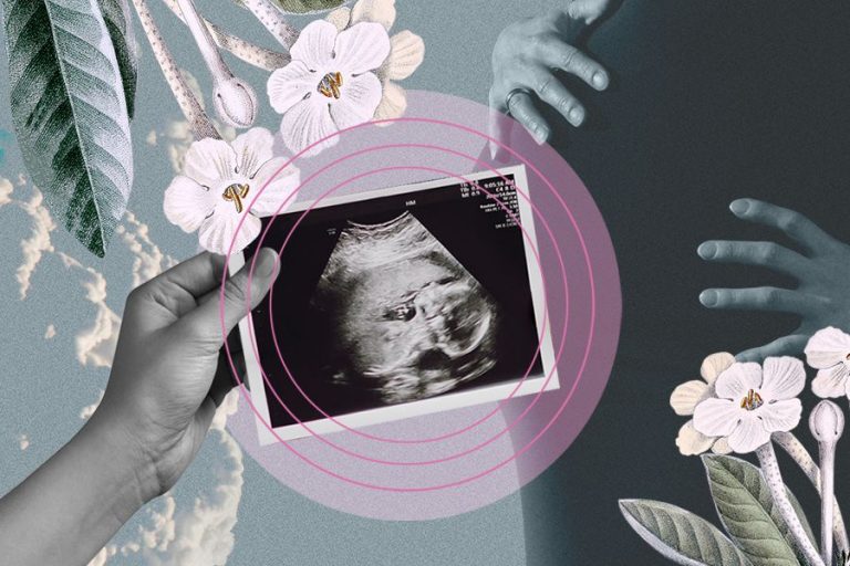 Lee más sobre el artículo Ley Dominga Chile, por un protocolo universal de atención medica en caso de muerte perinatal